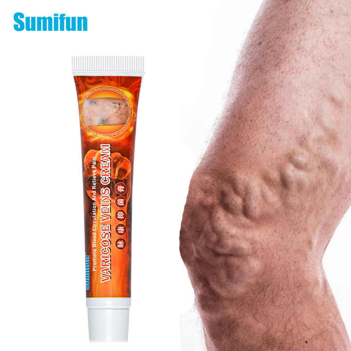 LAST DAY OF DISCOUNT 🔥 Sumifun - Varicose Veins Cream