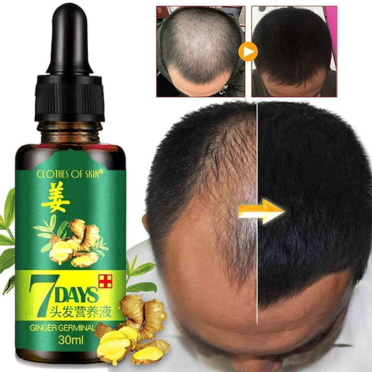 LAST DAY OF DISCOUNT 🔥 7 DAY GINGER GROWTH OIL