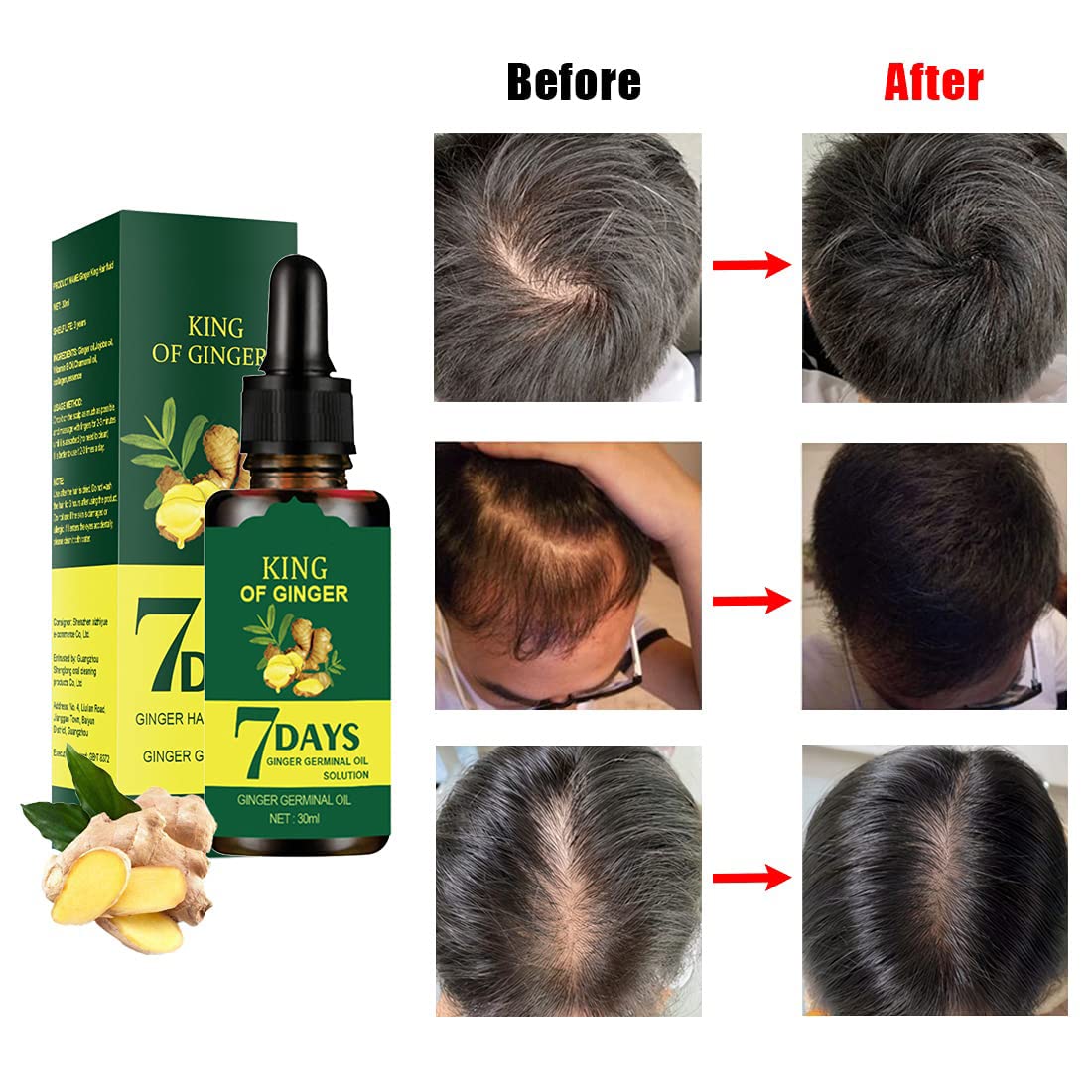 LAST DAY OF DISCOUNT 🔥 7 DAY GINGER GROWTH OIL