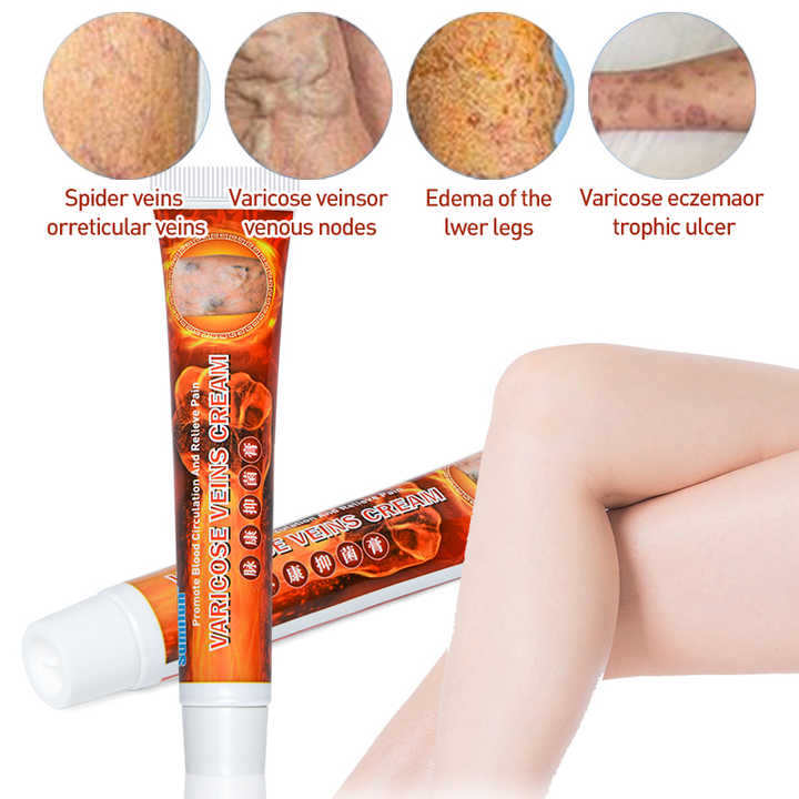 LAST DAY OF DISCOUNT 🔥 Sumifun - Varicose Veins Cream